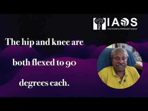 Hip Dislocation. Gravity Method or Reduction