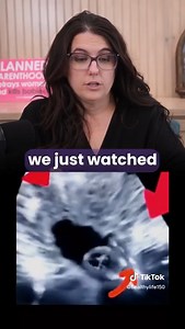 WARNING: GRAPHIC VIDEO - Harrowing footage of an abortion. There's no way this isn't murder. #ProLife #EndAbortion | CitizenGO USA