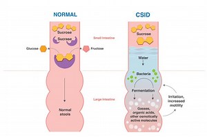 CSID Symptoms Are No Picnic - CSID For Healthcare Providers