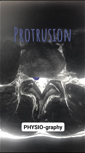 Vertebral column radiology | PHYSIO-graphy