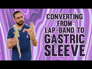 Converting from Lapband to Gastric Sleeve | Gastric Sleeve Surgery | Questions and Answers