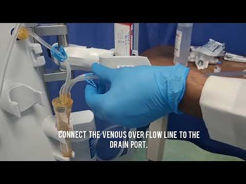 How to setup Dialysis Machine/priming/Nipro Surdial x dialysis machine