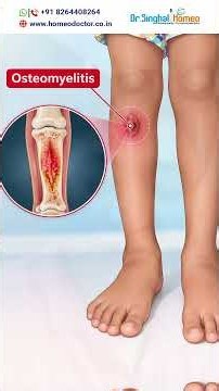 Osteomyelitis Testimonial: A Father Shares His Daughter’s Homeopathy Journey | Dr. Vikas Singhal