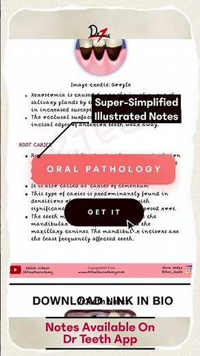 Oral Pathology Notes+