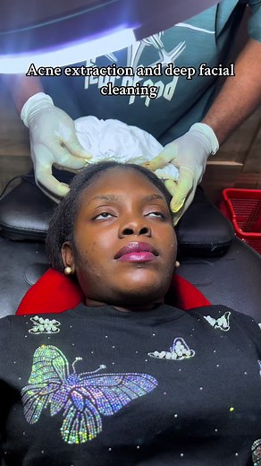 Face cleaning is really good for your facial skin #maxluxespa6 #fyp #fypviral #pimple #facial