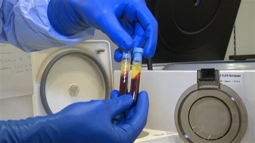 PAgT试验（血小板聚集试验，Platelet Aggregation Testing Video） - Kevin Bliden (480p, h264)