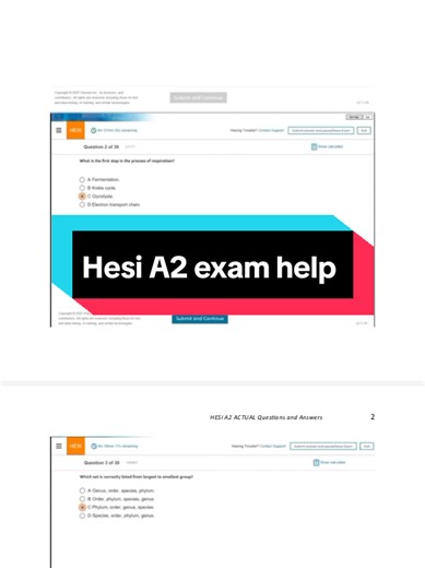 Struggling to pass your HESI A2 exam,Get all versions of updated 2026 hesi A2 exam! #hesi #hesia2 #hesia2exam #hesiexamhelp #nursingstudent