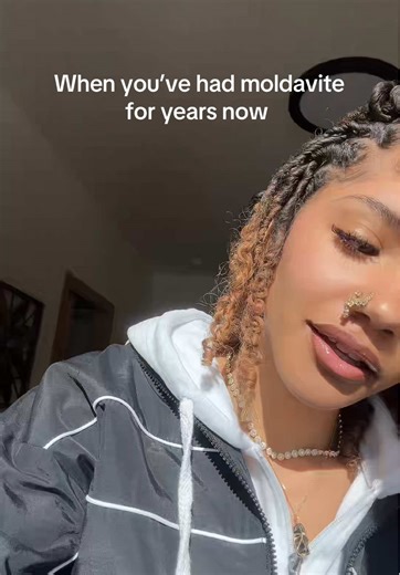 😂😂😂 | moldavite