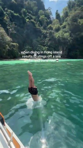 when diving in Hong island results to stings off a sea urchin and coral reef 😲 LaughLife Couple 🤪