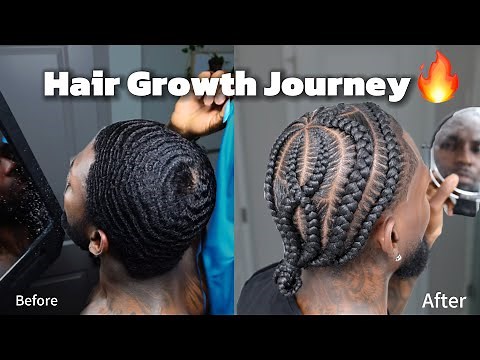 Before & After:My 80-Week Hair Growth Transformation (Full Journey)