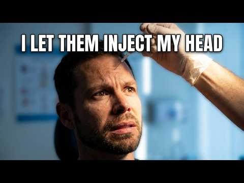 50 Injections to Save My Hair? I Actually Did It