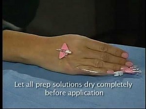 3M™ Tegaderm™ IV Securement Dressing for Nexiva Catheter | Application