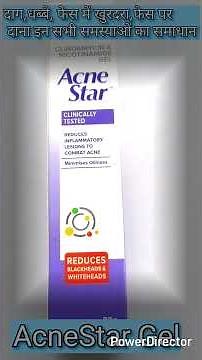 AcneStar gel full detail review...