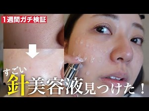 [Pore Elimination] Can the popular "needle beauty serum" surpass facial beauty devices? One-week ...