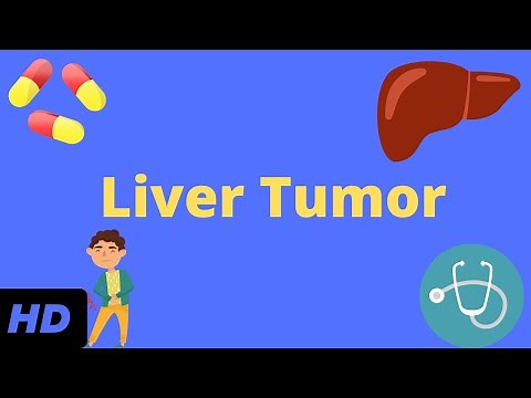 Liver Tumor, Causes, Signs and Symptoms, Diagnosis and Treatment.