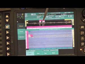 Birring NDE 207, TOFD Demonstration: Calibration and Inspection; Time of flight Diffraction # 2