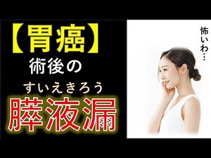 胃癌 合併症 膵液瘻 縫合不全 十二指腸 膵臓 2022