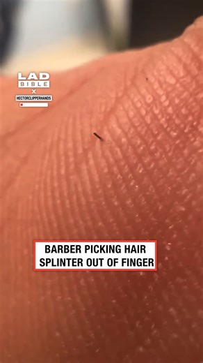 1.5M views · 1.1K reactions | How are they so small but so painful  | LADbible | Facebook