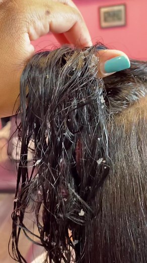 Dealing with Dry Scalp After a Keratin Treatment