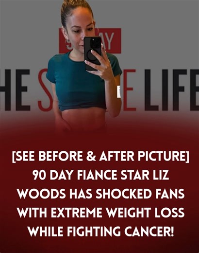 [See Before & After Picture] 90 Day Fiance Star Liz Woods Has Shocked Fans With Extreme Weight Loss While Fighting Cancer! 💬 Story continues below | 90 Day Fiance & TLC Shows Scoops