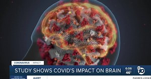 Study shows how COVID-19 attacks brain cells