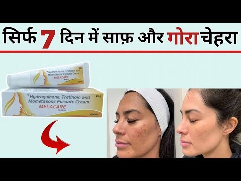 Melacare Cream Review | melacare cream, how to use melacare cream | melacare cream use side effects