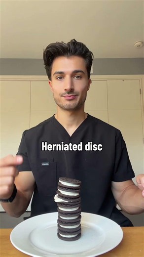 Spinal Abnormalities Explained 🦴🍪#doctor #orthopedics #spine #medstudent #medschool