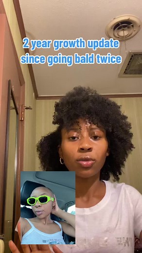2 Year Hair Growth Update: From Bald to Long & Healthy
