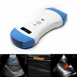 [Hot Item] Ms-W100 WiFi Wireless Mini Handheld Color Doppler Ultrasound Scanner