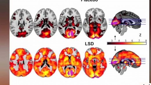 What effects does LSD have on our brain?