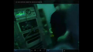 Robotic partial nephrectomy and 3-D Lap/Robotic ureteric reimplantation