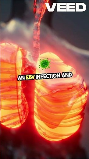 Detecting EBV Key to Diagnosis!