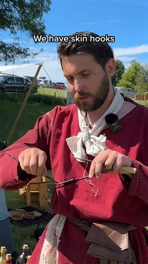 64K views · 469 reactions | What was ancient Roman surgery like @chalkehistoryfestival-001 | Melanie Rocha | Facebook