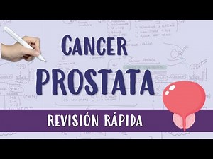 EASY PROSTATE CANCER