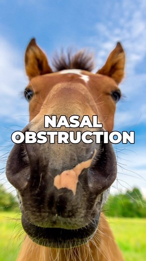 The cottle maneuver only works while you hold the valve open. … There are many reasons why you may have breathing problems. … It could be several at one time. … If you are a surgical candidate then make sure you see a skilled nasal surgeon. … Both ENT and Plastic Surgeons are competent for this procedure. … 🎥 Credit @dr.remix … #nose #breath | Ricky Brown