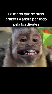 La morra que se puso brakets y ahora por todo pela los dientes | brackets