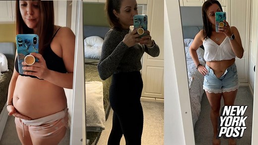 Woman says giant ovarian cyst made her look like she was pregnant