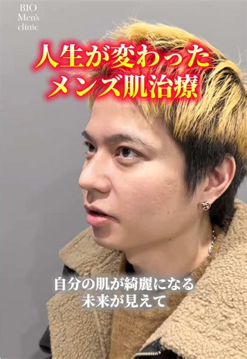 人生が変わったメンズ肌治療✨️ 今の時代、男🚹でもお肌に課金している方が多いです！ どうせお金高いでしょとか思わないで、まずは1度相談しに来てください😊お客様にとって素晴らしい施術をご提案させて頂きます❤️‍🔥 4/6BIO心斎橋院にて、みく先生いますのでこの機会を逃す4月は出張ありません！ 今のままでいいんですか？ 変わりたいって思ったらすぐ行動してみましょ💪 #メンズ美容 #ニキビ跡 #ニキビ #サブシジョン
