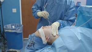 What is Chin Liposuction?