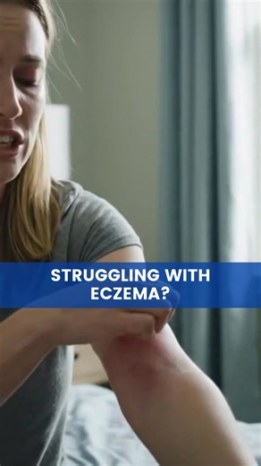Struggling with eczema? Consider a potential treatment study at no cost before all spots are filled 👇 Participants may receive: ✅ Potential eczema treatment ✅ Time with a dermatologist ✅ Compensation for study-related time & travel No insurance is required. 👉 Sign up now to see if this study is right for you | Patients VIP