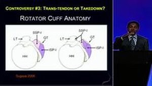 Strategies and Techniques in Partial Thickness Rotator Cuff Tears