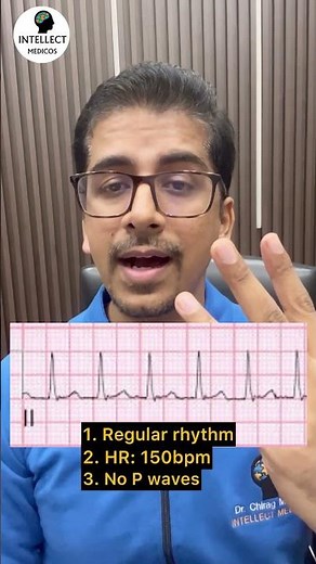 Interpret the ECG #ecg #ekg #cardiology