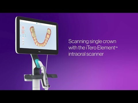 How to review single crown scans with the iTero Element™ Plus scanner | post-scanning workflow