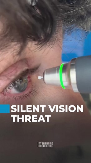 Laser Eye Surgery: Precision Treatment Explained