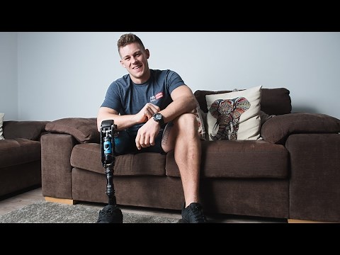 One-Legged Model Becomes Catwalk Star