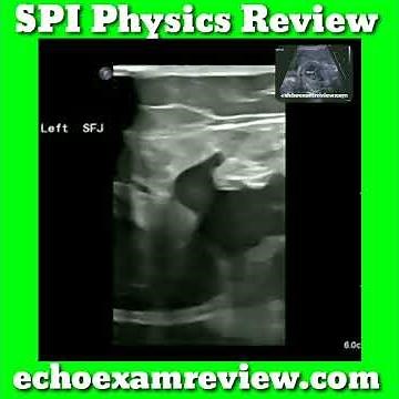 Spatial Resolution Artifacts