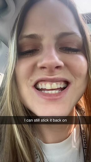 Emergency Dental Care: How to Handle a Broken Tooth in Children