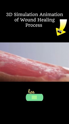 Arm Wound Healing Animation #woundhealing #wound #skinhealing #ointment #wounds