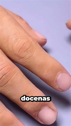 The liquid they covered his arm with turned into something incredible