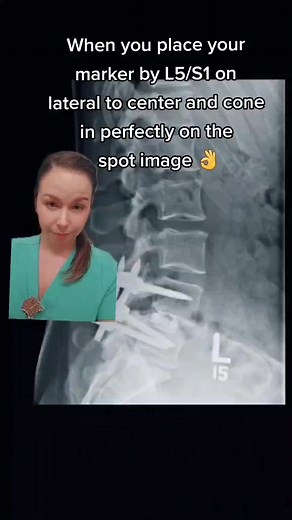What xray tricks do you use? #xray #xraytech #xraytechnologist #xraystudent #radiology #radtech #radiologytechnologist #cttech #cttechnologist #radiography #radtech #xraytechlife #radiologyschool #radtechhumor #radtechstudent | Xray Girl Creations